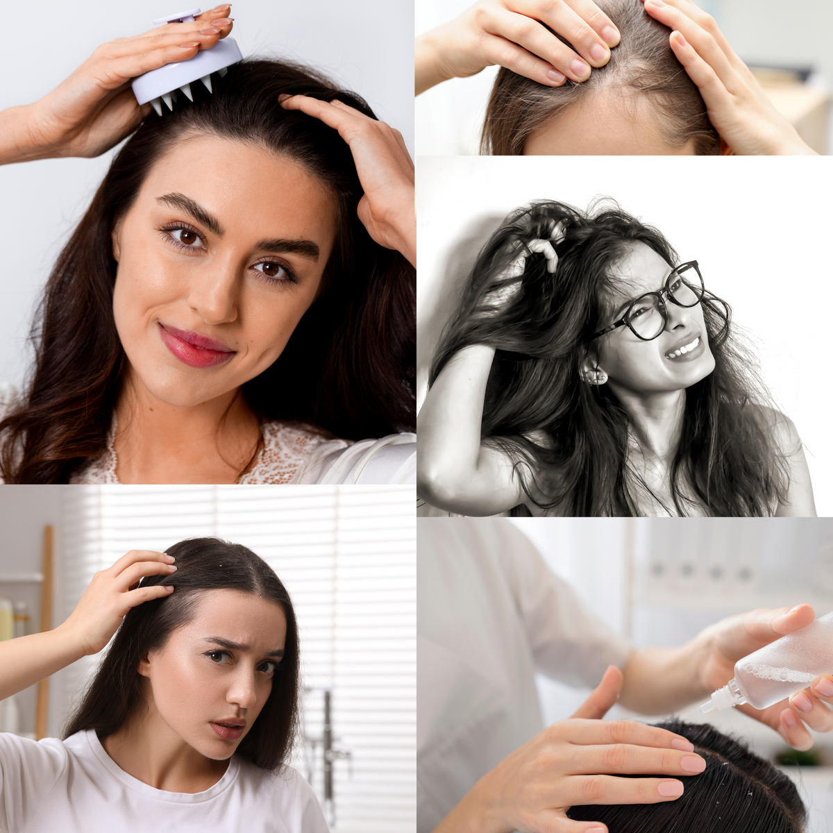 Scalp Health pictures of various women showing concern or care for their scalp